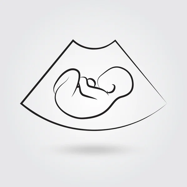 Ultrasonic picture of unborn baby — Stock Vector