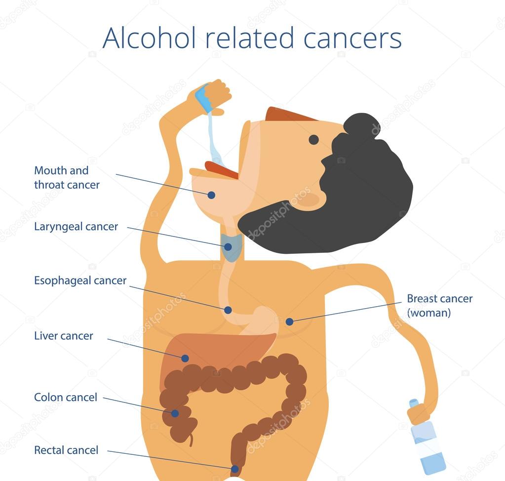 Alcohol causes seven cancers illustration.