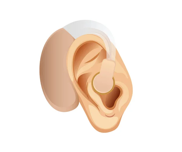 Illustration Isolated Vector Ear Hearing Aid — Stock Vector