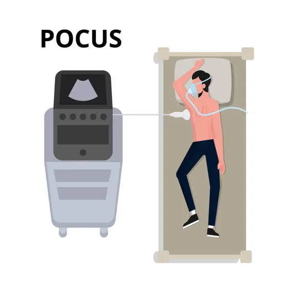 Pocus超音波のイラスト ベッドサイド肺超音波診断の概念 — ストックベクタ