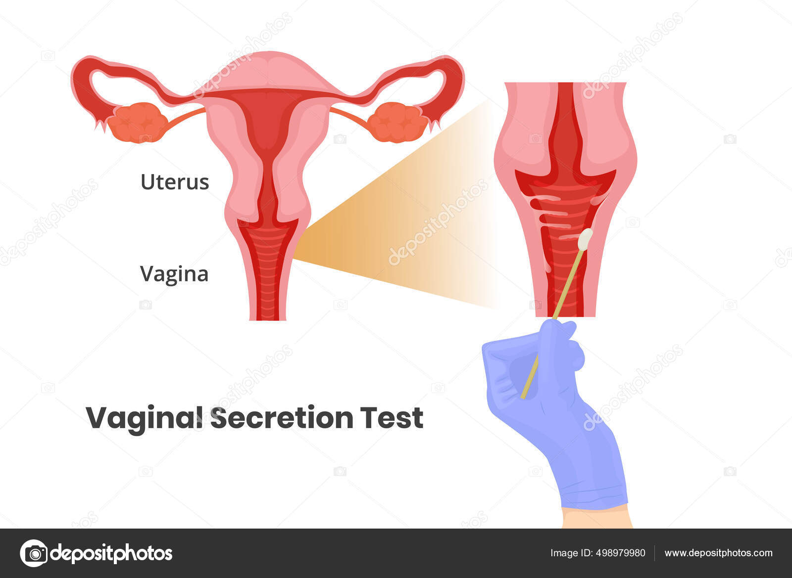 Vaginal Secretion Test Doctor's Hand Glove Taking Swab Vaginal Wall