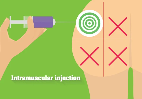 Intramuscular injection vector illustration. Technique of intramuscular injection into dorsogluteal site. — Stock Vector