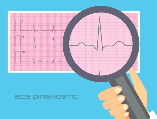 Normální EKG vektorové ilustrace. Konceptuální ilustrace interpretaci EKG — Stockový vektor