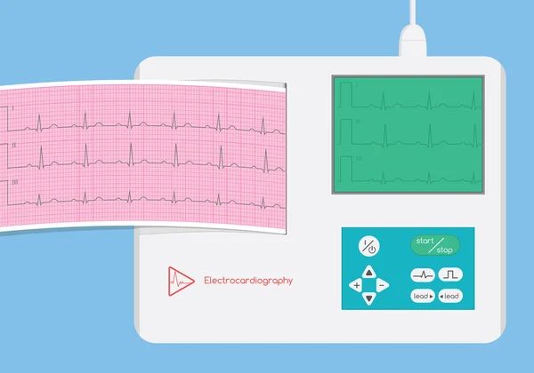 Eletrocardiógrafo com monitor e tira de ecg ilustração — Vetor de Stock