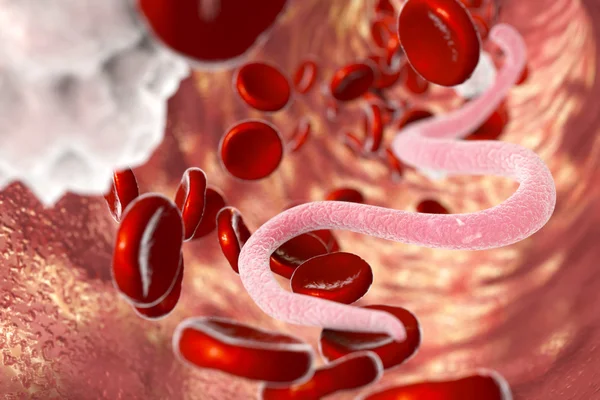 Parasiet in menselijk bloed — Stockfoto