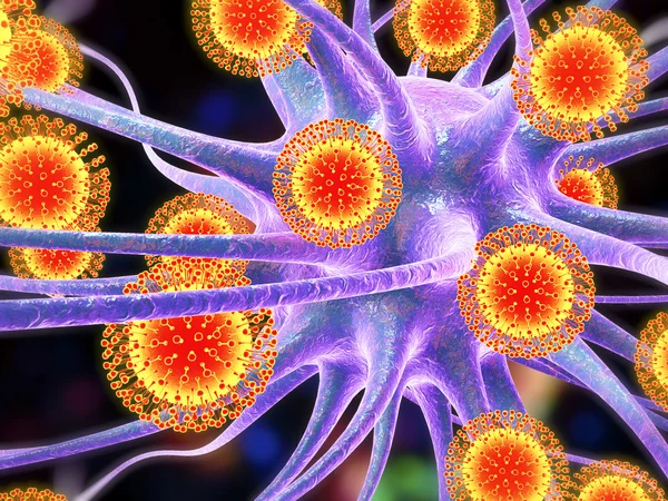 Zika viruses infecting brain cells — Stock Photo, Image