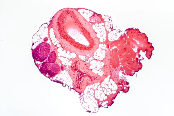筋性動脈の光学顕微鏡像 — ストック写真