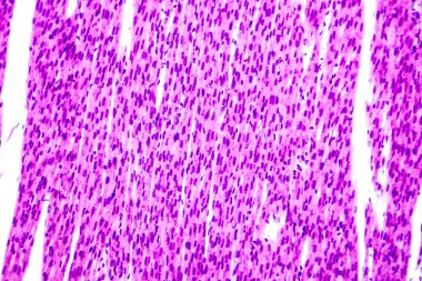 Heart muscle, light micrograph clipart