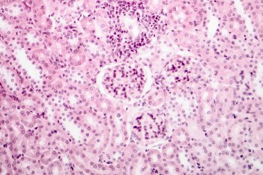 Böbreğin hafif mikrografı