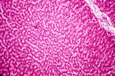 Bir karaciğer hafif test