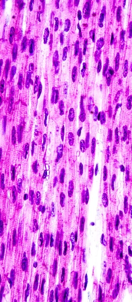 Мышцы сердца, легкий микрограф — стоковое фото