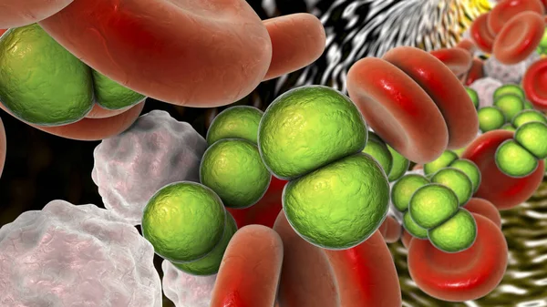 Meningococcemia Dissemination Bacteria Nesseria Meningitidis Meningococci Bloodstream Illustration — ストック写真