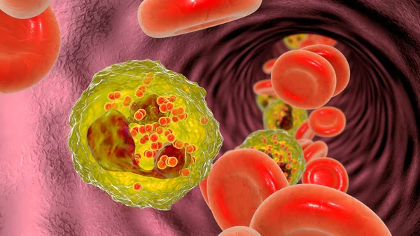 Meningococcemia Bacteria Neisseria Meningitidis Bloodstream Neutrophils Illustration — ストック写真