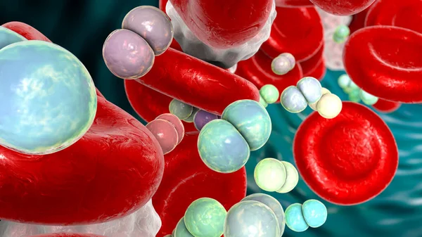 Meningococcemia Dissemination Bacteria Nesseria Meningitidis Meningococci Bloodstream Illustration — Φωτογραφία Αρχείου