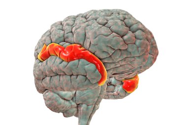 Human brain with highlighted superior temporal gyrus, 3D illustration. It is located in the temporal lobe, contains the auditory cortex, is responsible for the sensation of sound and the processing of speech