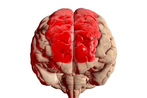 Людський Мозок Підсвіченою Верхньою Лобовою Звивиною Також Граничною Звивиною Видом — стокове фото