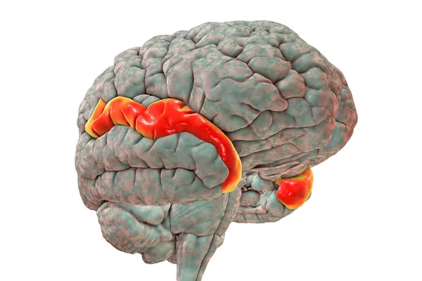 Human Brain Highlighted Superior Temporal Gyrus Illustration Located Temporal Lobe — Foto de Stock