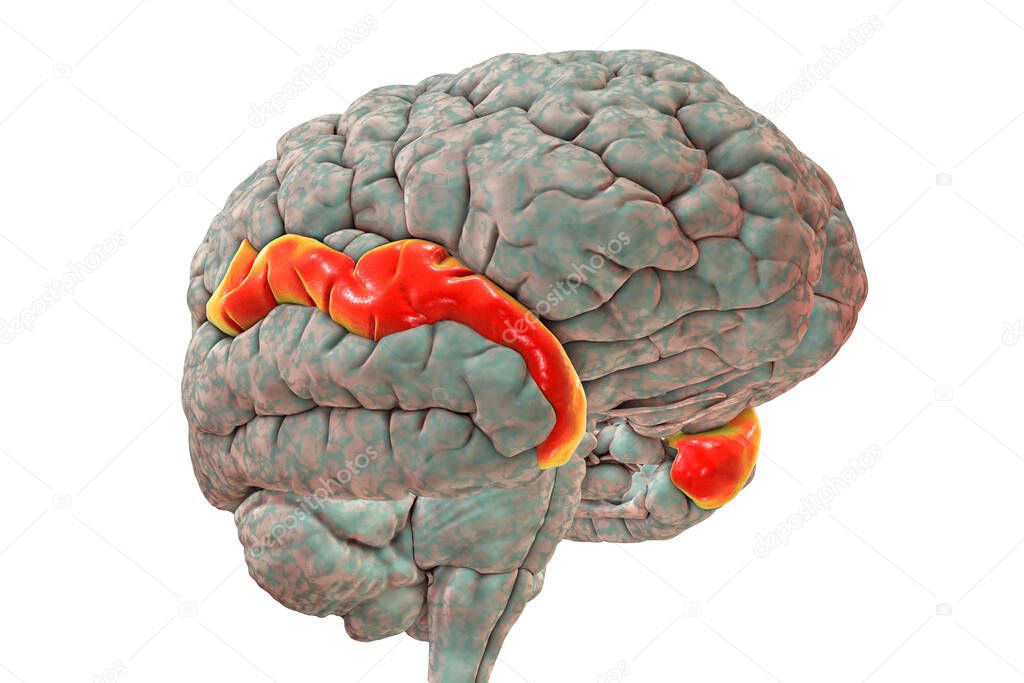 Human brain with highlighted superior temporal gyrus, 3D illustration. It is located in the temporal lobe, contains the auditory cortex, is responsible for the sensation of sound and the processing of speech