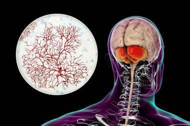 Beyinciği vurgulanmış ve Purkinje nöronlarına yakından bakan insan beyni, beyincik korteksindeki en yaygın hücre tiplerinden biri, 3 boyutlu resimleme
