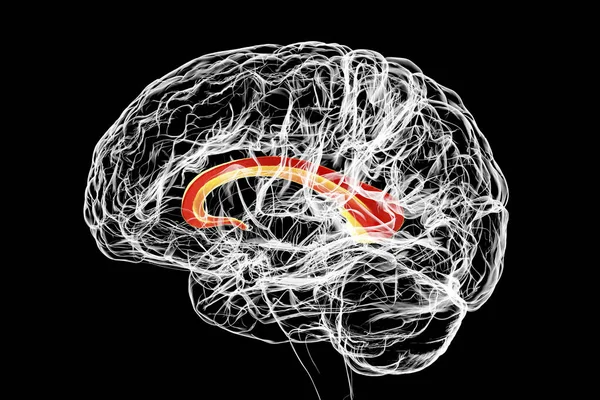 Cerebro Humano Con Corpus Callosum Resaltado También Conocido Como Comisura — Foto de Stock