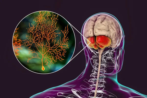 Menschliches Gehirn Mit Hervorgehobenem Kleinhirn Und Nahaufnahme Von Purkinje Neuronen — Stockfoto