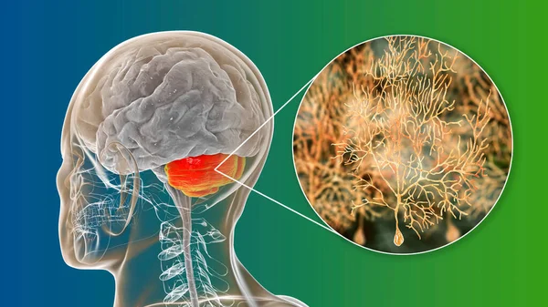 脳皮質の最も一般的なタイプの細胞の1つであるプルキンエ神経細胞のハイライトされた小脳とクローズアップビューを持つ人間の脳 3Dイラスト — ストック写真
