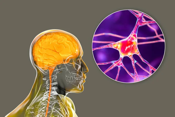 神経細胞 脳細胞 3Dイラストをクローズアップした体内の人間の脳 — ストック写真
