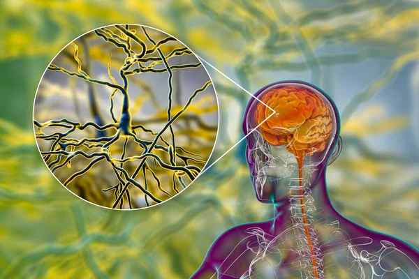 神経細胞 脳細胞 3Dイラストをクローズアップした体内の人間の脳 — ストック写真