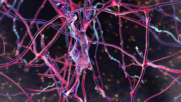 Neurones Cellules Cérébrales Situés Dans Les Pons Varolii Cerveau Humain — Photo