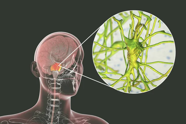 ハイライトされた武器を持つ人間の脳Varoliiと武器に位置するピラミッド型のニューロンのクローズアップビュー 3Dイラスト — ストック写真