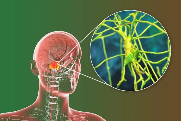 Cerebro Humano Con Puntos Destacados Varolii Vista Cerca Las Neuronas —  Fotos de Stock