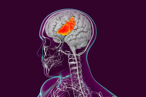 Cerebro Humano Cuerpo Con Giro Frontal Inferior Resaltado Ilustración Encuentra —  Fotos de Stock
