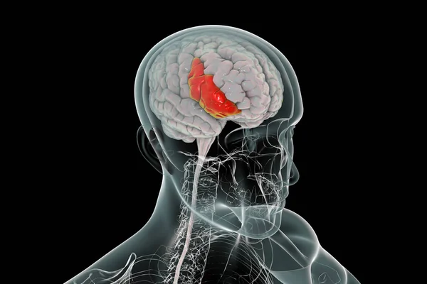 Menselijke Hersenen Het Lichaam Met Gemarkeerde Inferieure Frontale Gyrus Illustratie — Stockfoto