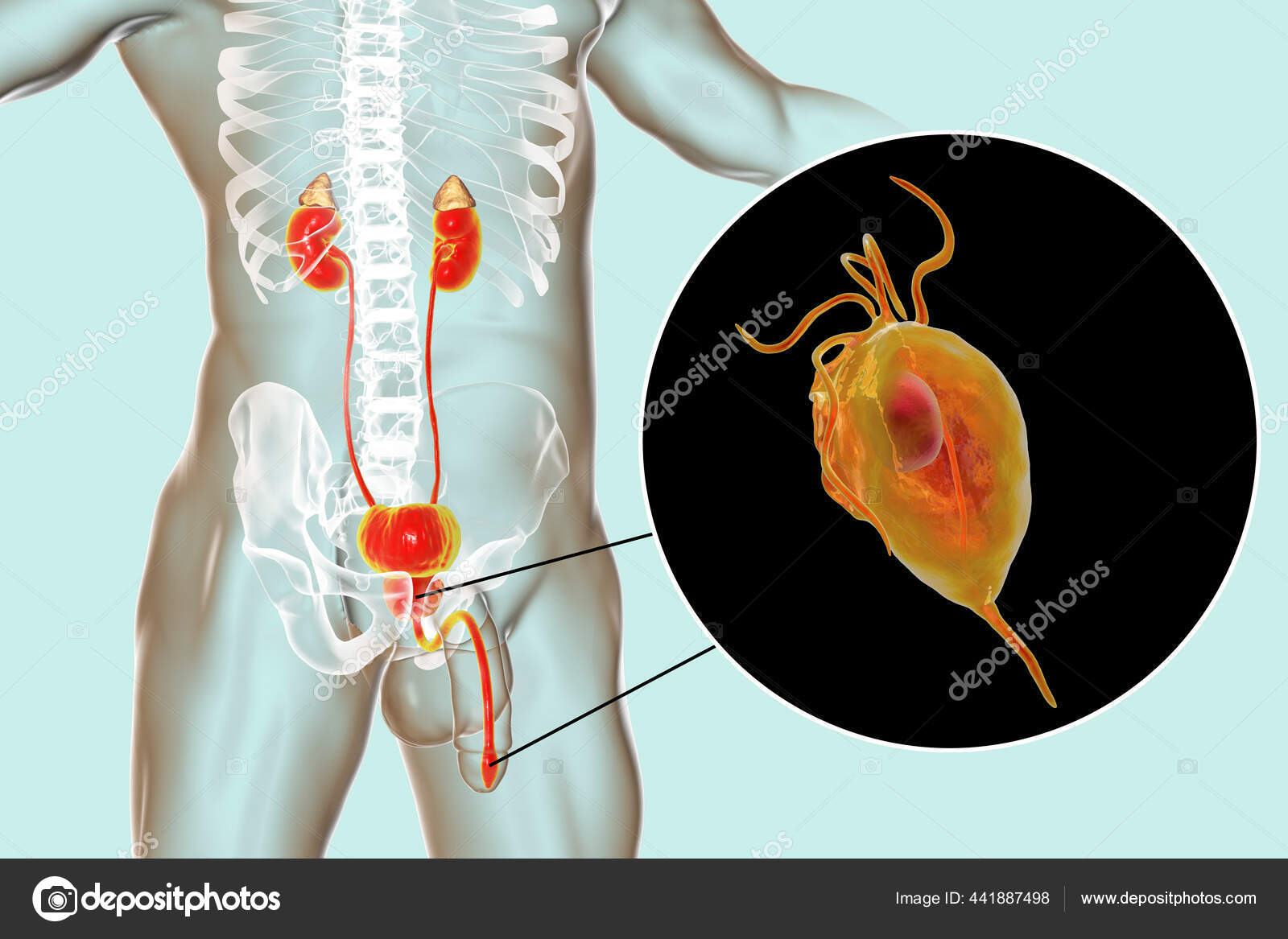 Uretrita in prostatita