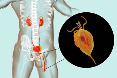 İnsanda trikomonez enfeksiyonu, erkekte anatomi üreme sistemi ve üretrit ve prostatite neden olan Trikomonas vajinalis protozoanın yakın çekim görüntülerini gösteren 3 boyutlu illüstrasyon.