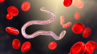 Wucheria bancrofti, bir yuvarlak solucan nematodu, lenfatik filariazisin nedensel etkenlerinden biri, 3 boyutlu illüstrasyon solucan ve kuyruk çekirdeğinin etrafında kılıf olduğunu gösteriyor.