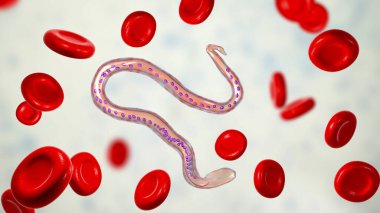 Wucheria bancrofti, bir yuvarlak solucan nematodu, lenfatik filariazisin nedensel etkenlerinden biri, 3 boyutlu illüstrasyon solucan ve kuyruk çekirdeğinin etrafında kılıf olduğunu gösteriyor.