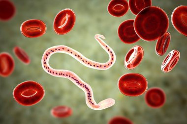 Wucheria bancrofti, bir yuvarlak solucan nematodu, lenfatik filariazisin nedensel etkenlerinden biri, 3 boyutlu illüstrasyon solucan ve kuyruk çekirdeğinin etrafında kılıf olduğunu gösteriyor.