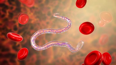 Wucheria bancrofti, bir yuvarlak solucan nematodu, lenfatik filariazisin nedensel etkenlerinden biri, 3 boyutlu illüstrasyon solucan ve kuyruk çekirdeğinin etrafında kılıf olduğunu gösteriyor.