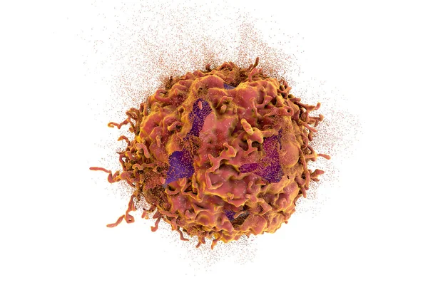 癌細胞の破壊 3Dイラスト 癌治療と予防の概念 — ストック写真