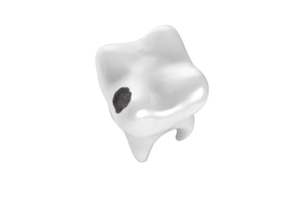 有黑洞的人类牙齿 3D图解 — 图库照片