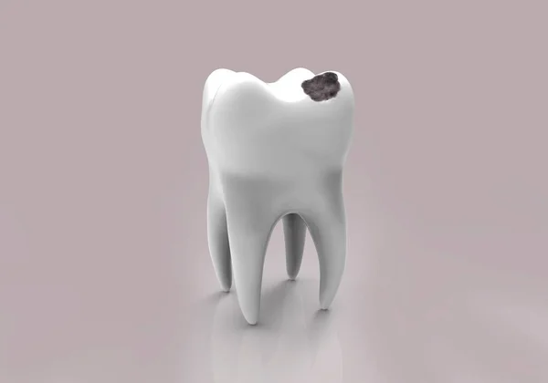 Lidský Zub Černou Dírou Zubní Kaz Ilustrace — Stock fotografie