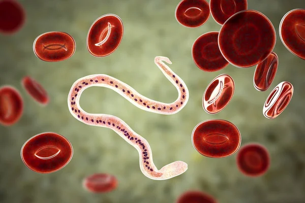 Wuchereria Bancrofti Nematodo Lombriz Redonda Uno Los Agentes Causantes Filariasis — Foto de Stock