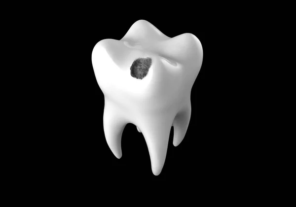 Ludzkie Zęby Czarną Dziurą Próchnica Dentystyczna Ilustracja — Zdjęcie stockowe
