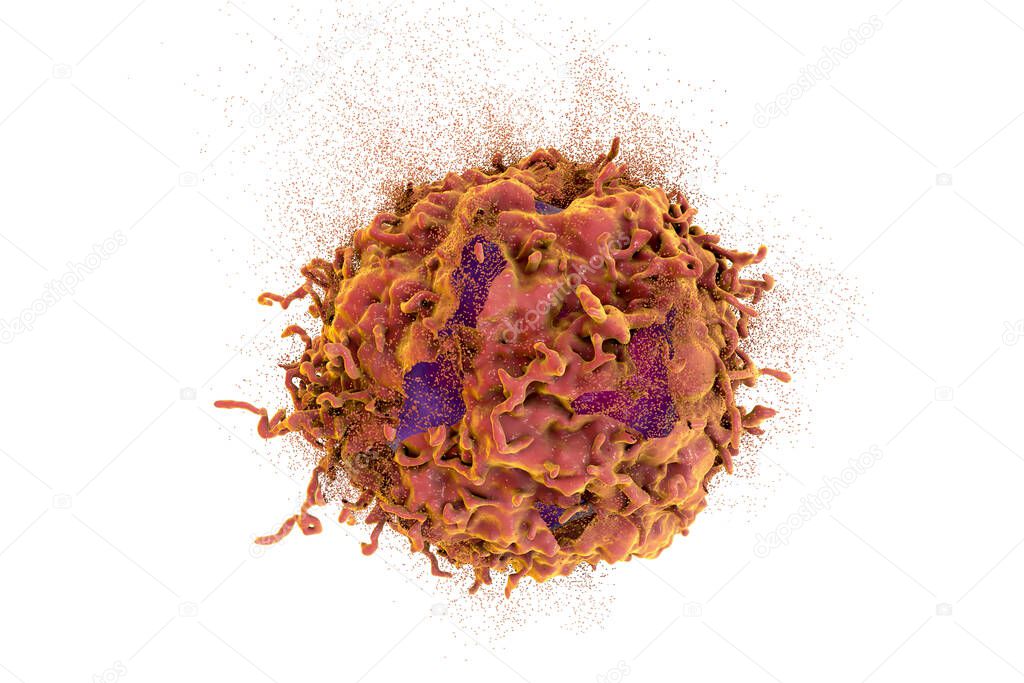 Destruction of cancer cell, 3D illustration. Concept of cancer treatment and prevention