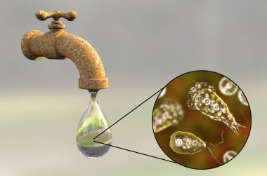 Brain-eating amoeba awareness concept. 3D illustration showing potential way of aquiring infection during ritual nasal rinsing. Trophozites of Naegleria fowleri can be present in dirty tap water clipart