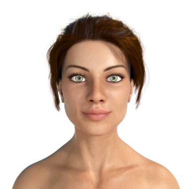 Dudak büyütme, 3 boyutlu illüstrasyon ameliyattan sonra kadınlarda dudak gösterimi