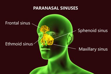 Parazal sinüslerin anatomisi. 3 boyutlu illüstrasyon, parantez sinüsleri, alın, üst çene, etmoid ve sfenoidli bir erkek olduğunu gösteriyor. Etiketlenmiş resim