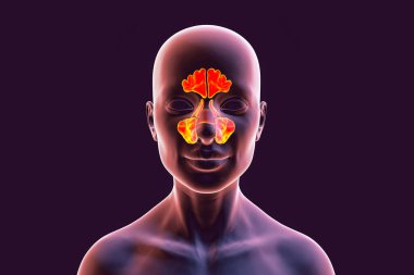 Parazal sinüslerin anatomisi. 3 boyutlu illüstrasyon, parantez sinüsleri, alın, üst çene, etmoid ve sfenoidli kadınları gösteriyor.
