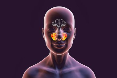 Parazal sinüslerin anatomisi. 3D çizimler üst çene sinüsleri vurgulanmış bir kadını gösteriyor. Highmore antrumu olarak da bilinir.